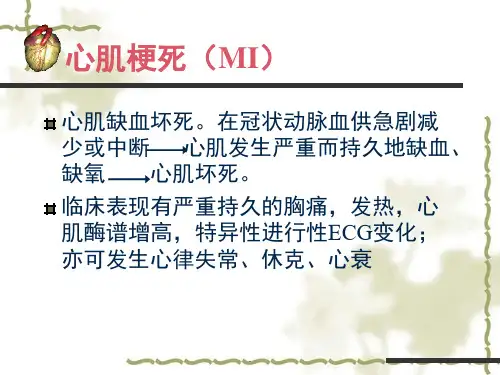 急性心肌梗死护理课堂PPT