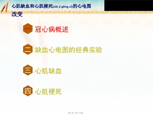202X年心肌缺血与心肌梗死心电图改变