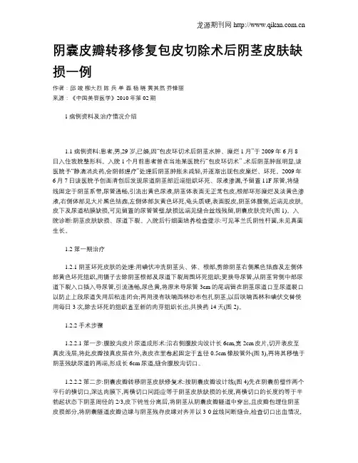 阴囊皮瓣转移修复包皮切除术后阴茎皮肤缺损一例