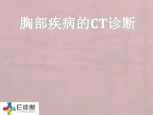 医学影像-胸部疾病的CT诊断