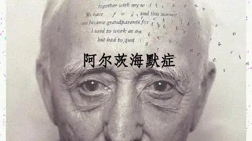 阿尔茨海默症ppt课件