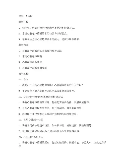 心脏超声诊断教案模板范文