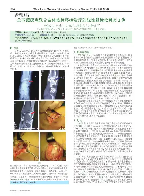 关节镜探查联合自体软骨移植治疗剥脱性距骨软骨炎1例