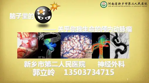 动脉瘤介入栓塞术PPT课件