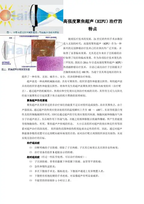高强度聚焦超声