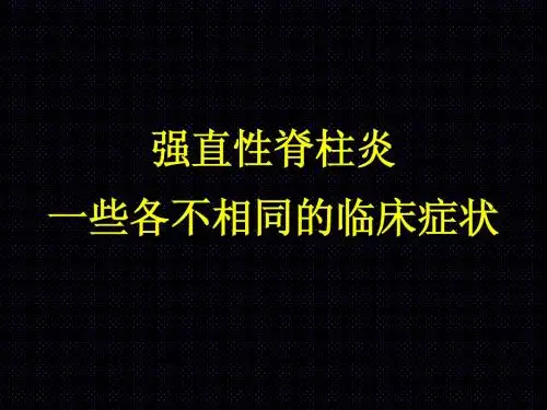 强直性脊柱炎一些各不相同的