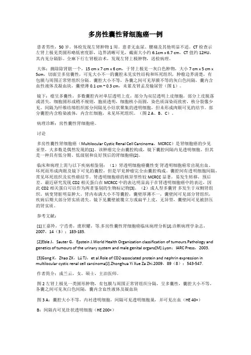 多房性囊性肾细胞癌一例