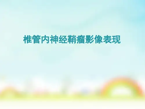 椎管内神经鞘瘤影像表现-PPT精品课件