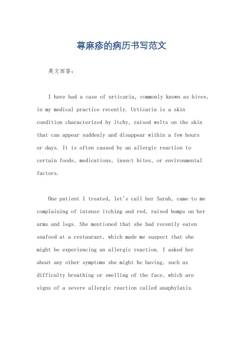 荨麻疹的病历书写范文