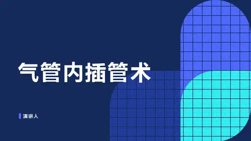 气管内插管术