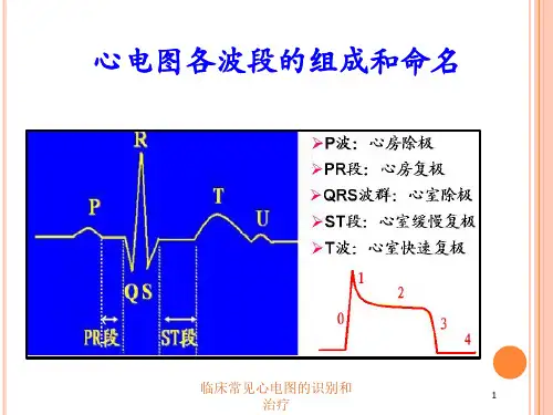 临床常见心电图的识别和治疗培训课件