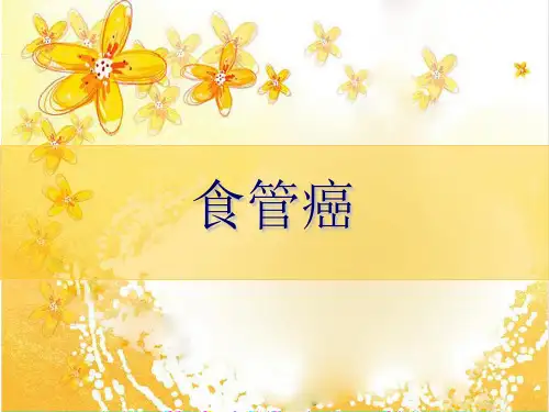 食管癌  ppt课件