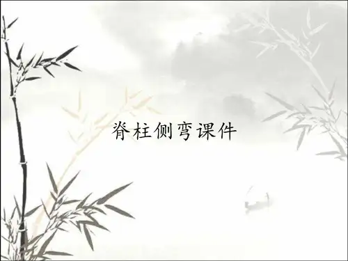 脊柱侧弯课件