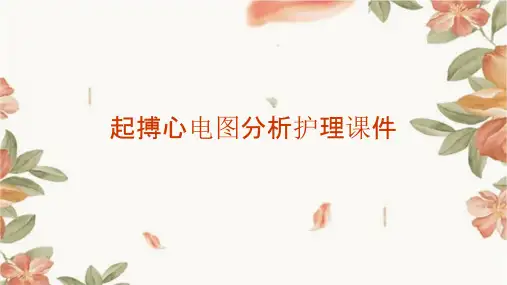 起搏心电图分析护理课件