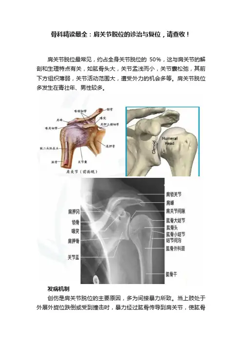 骨科精读最全：肩关节脱位的诊治与复位，请查收！