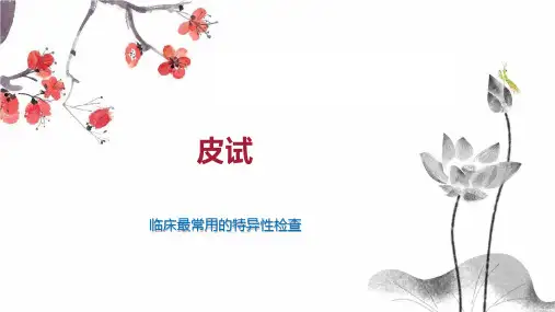 皮试    