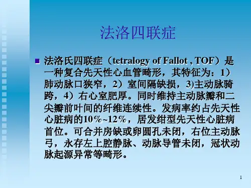 (参考课件)法洛四联症