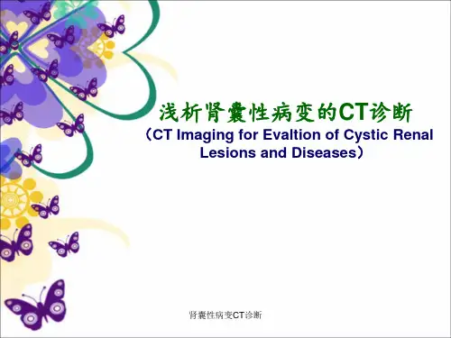 肾囊性病变CT诊断 ppt课件