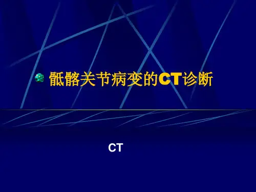 骶髂关节病变CT诊断