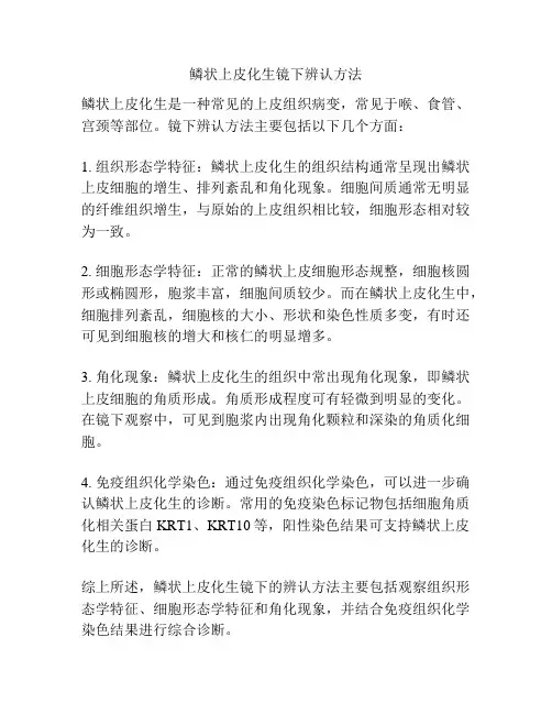 鳞状上皮化生镜下辨认方法