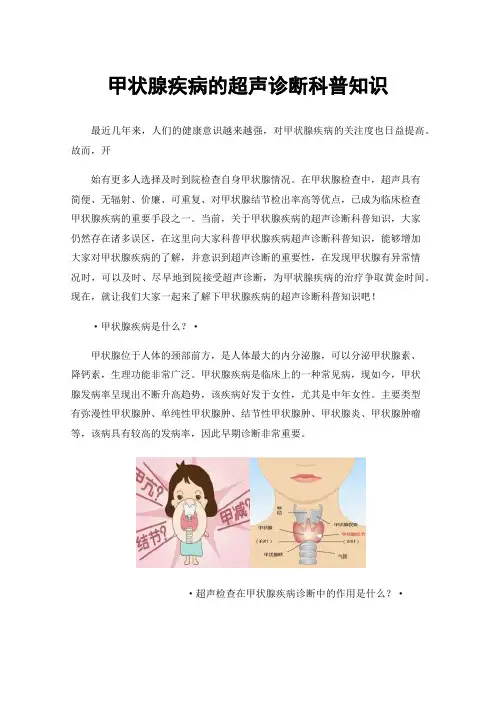 甲状腺疾病的超声诊断科普知识
