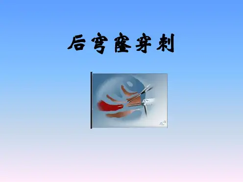 临床技能课件：2_妇产科技能— 后穿、诊刮