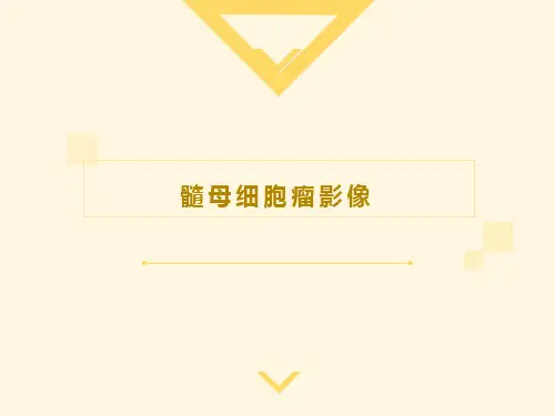 髓母细胞瘤影像
