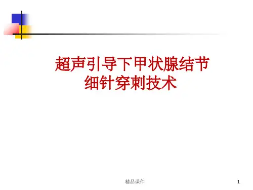 甲状腺结节细针穿刺