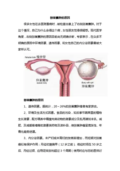 女性卵巢囊肿的原因