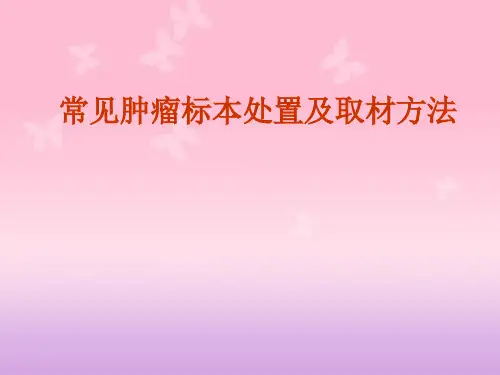 常见肿瘤标本处置及取材方法