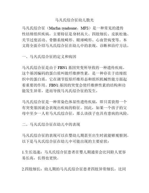 马凡氏综合征幼儿散光