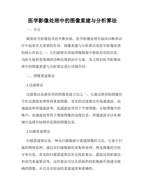 医学影像处理中的图像重建与分析算法