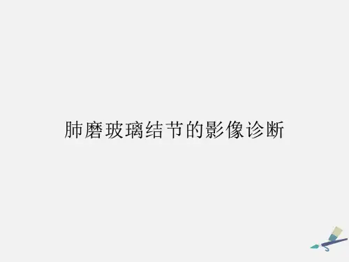 肺磨玻璃结节的影像诊断