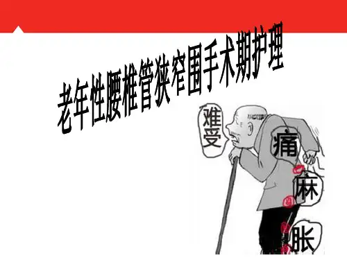 腰椎管狭窄护理查房