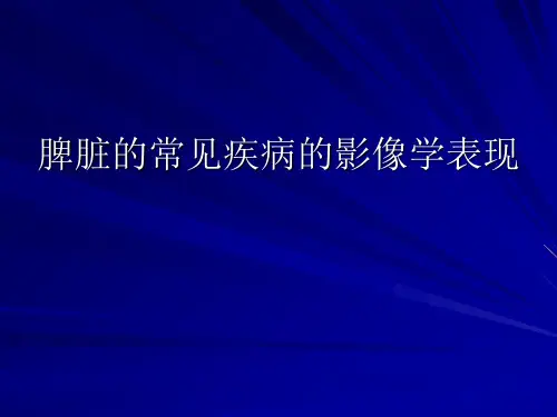 脾脏常见疾病的CT诊断