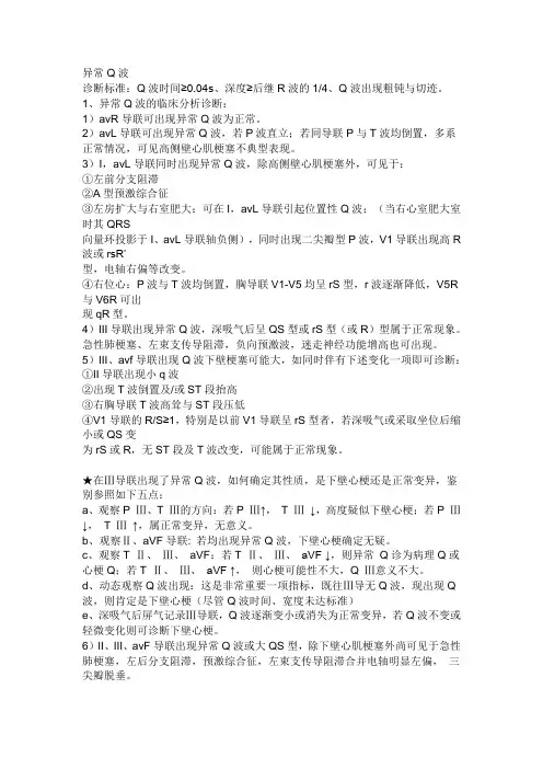 异常Q波