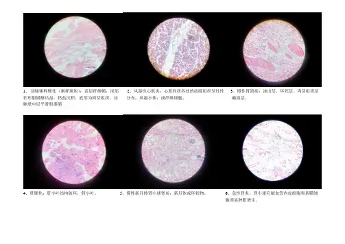 病理学切片