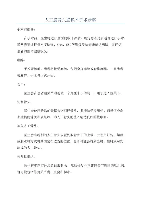 人工股骨头置换术手术步骤