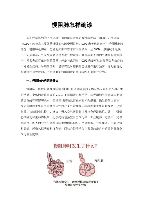 慢阻肺怎样确诊
