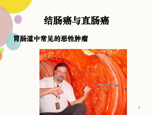结肠癌与直肠癌PPT课件