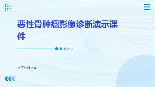 (医学课件)恶性骨肿瘤影像诊断演示课件