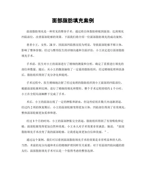 面部脂肪填充案例