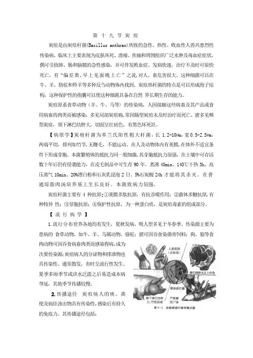 炭疽