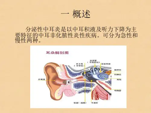分泌性中耳炎的护理讲解学习