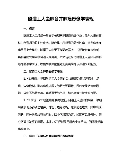 隧道工人尘肺合并肺癌影像学表现