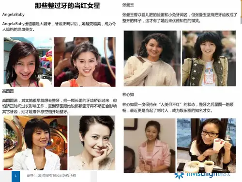 隐形矫正培训培训课件