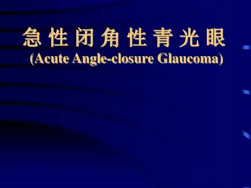 急性闭角型青光眼医学PPT课件