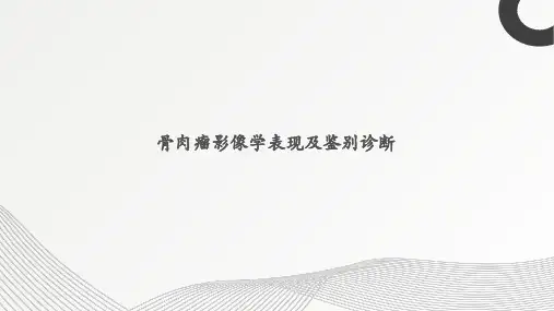 骨肉瘤影像表现及鉴别诊断
