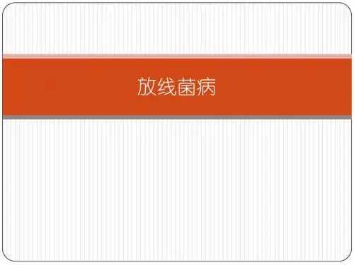 放线菌病