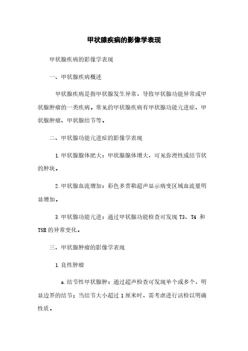 甲状腺疾病的影像学表现